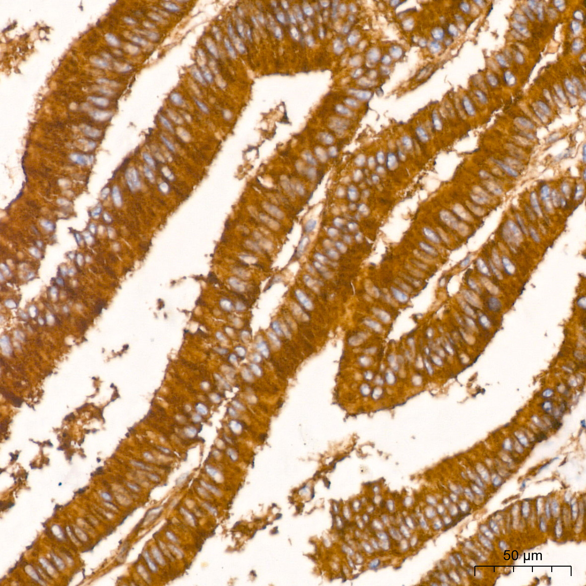 Clathrin heavy chain Rabbit Monoclonal Antibody - Image 2
