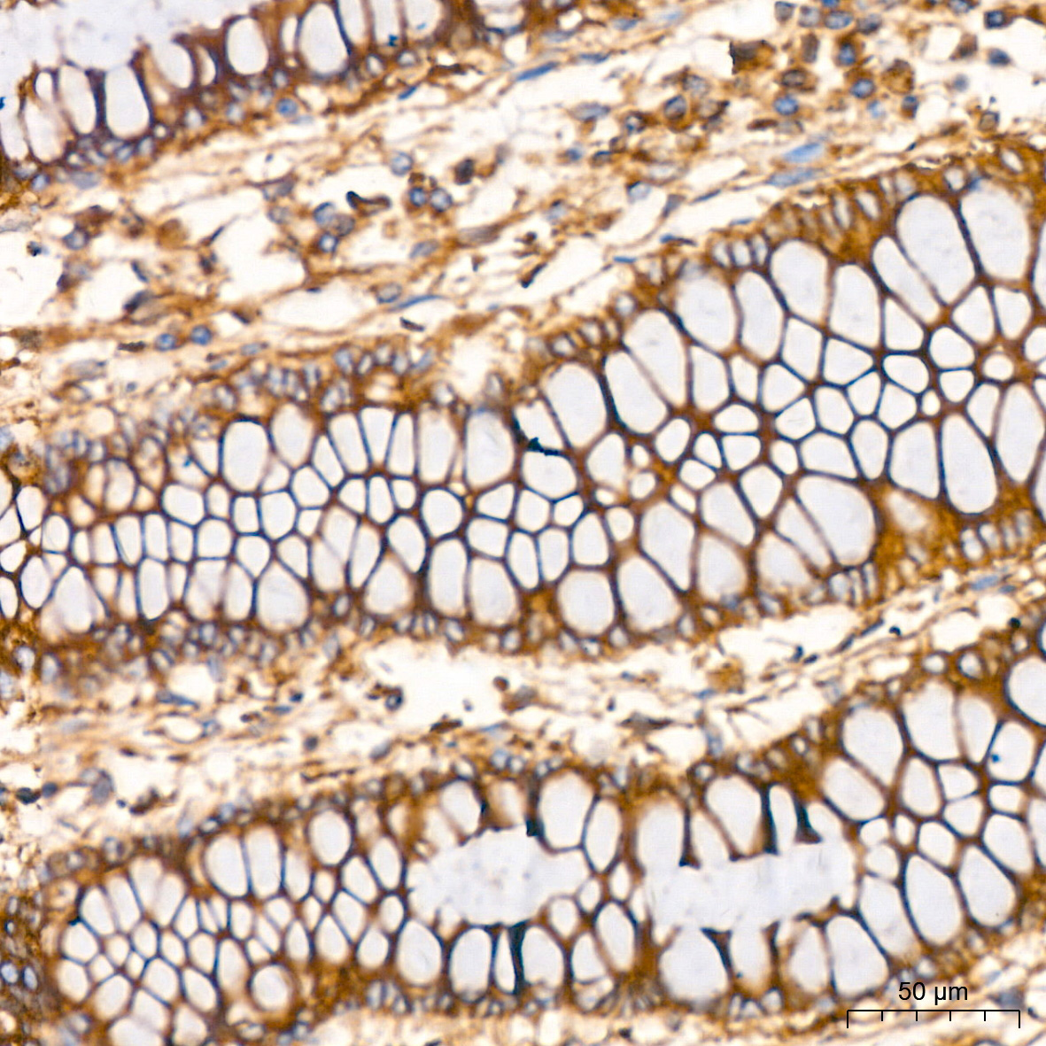 Clathrin heavy chain Rabbit Monoclonal Antibody - Image 3