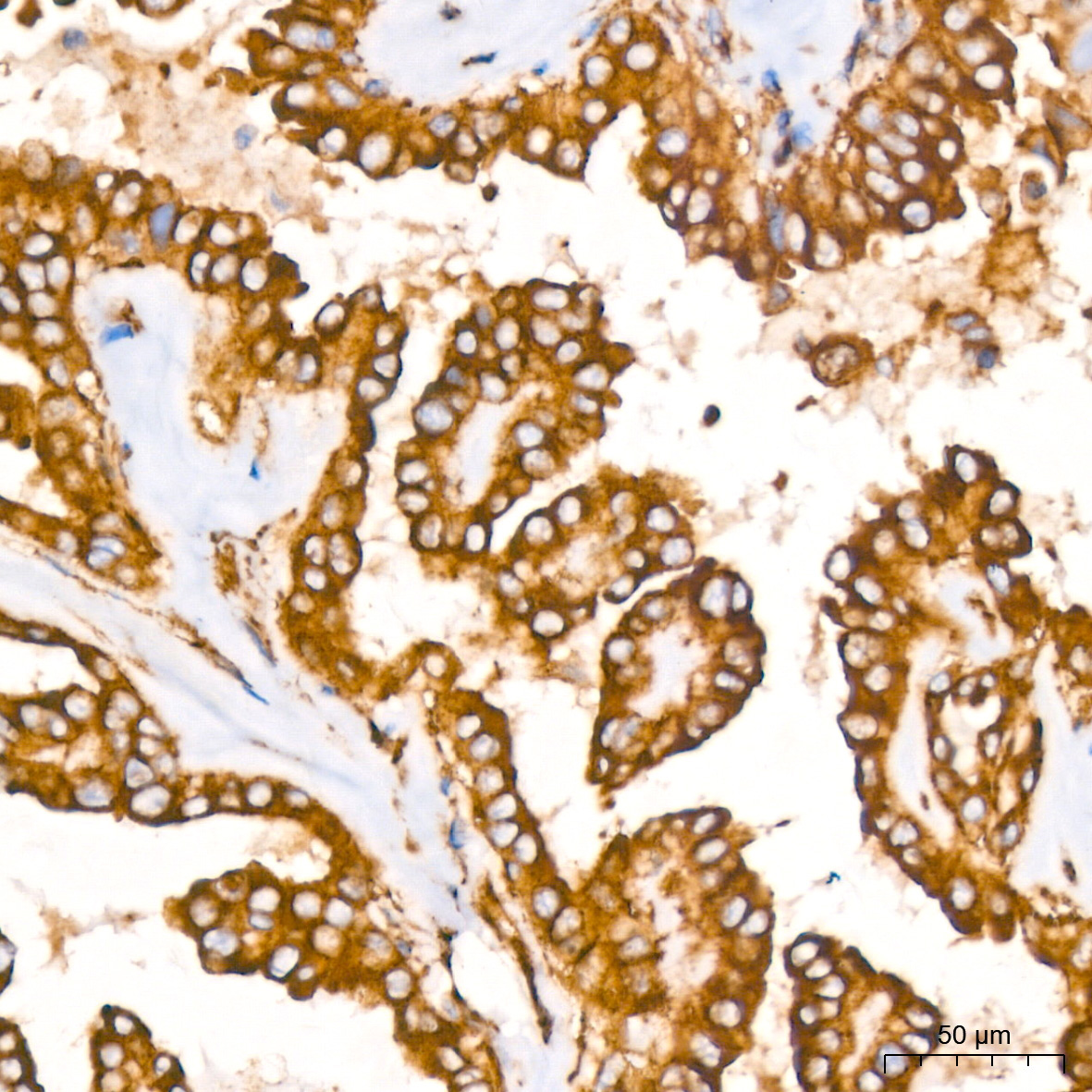 Clathrin heavy chain Rabbit Monoclonal Antibody - Image 4