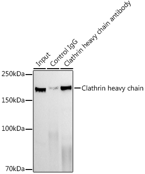 Clathrin heavy chain Rabbit Monoclonal Antibody - Image 6