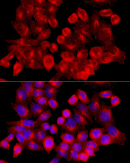 Clathrin heavy chain Rabbit Polyclonal Antibody - Image 2