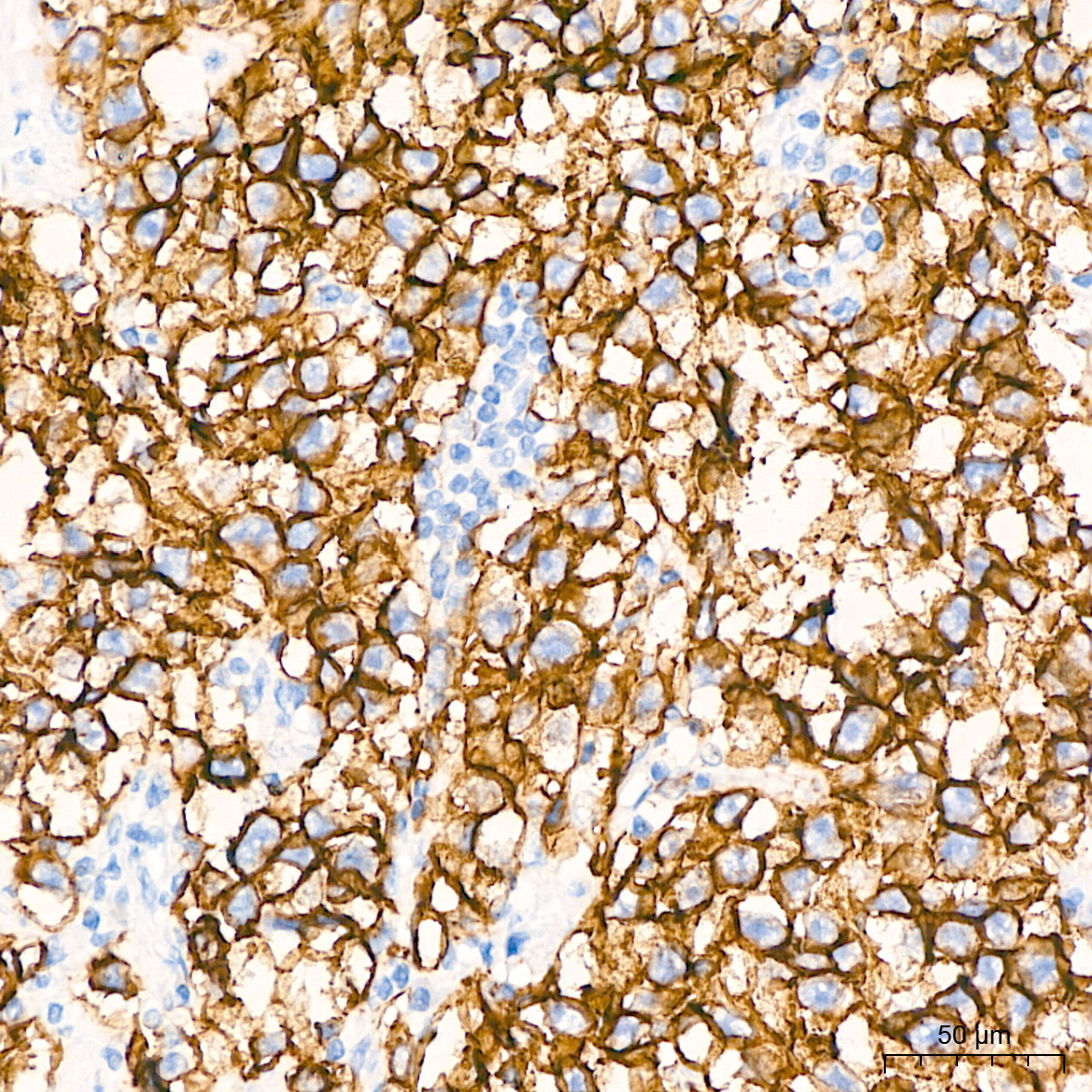 Claudin 6 Rabbit Monoclonal Antibody - Image 3