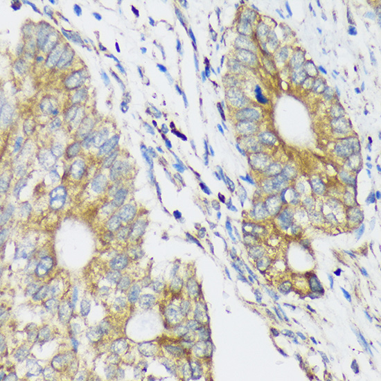 CLCC1 Rabbit Polyclonal Antibody - Image 2