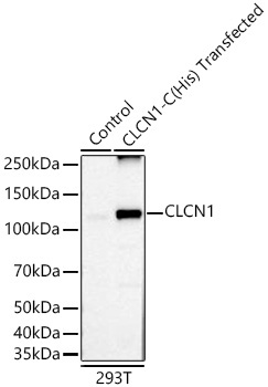 CLCN1 Rabbit Monoclonal Antibody