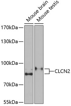 CLCN2 Rabbit Polyclonal Antibody