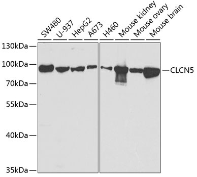 CLCN5 Rabbit Polyclonal Antibody
