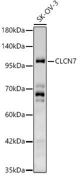 CLCN7 Rabbit Polyclonal Antibody