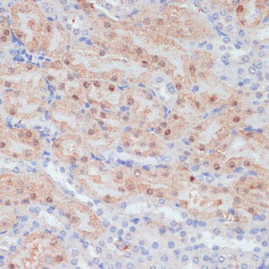 CLDN17 Rabbit Polyclonal Antibody - Image 2