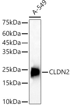 CLDN2 Rabbit Polyclonal Antibody - Image 2