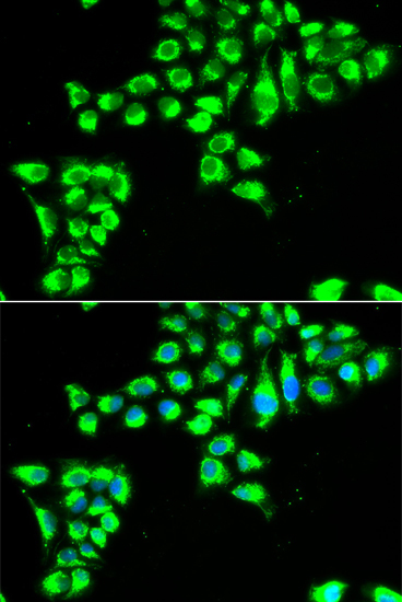 CLDN2 Rabbit Polyclonal Antibody - Image 2