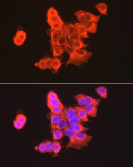 CLDN3 Rabbit Polyclonal Antibody - Image 3