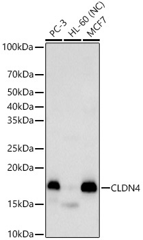CLDN4 Rabbit Polyclonal Antibody