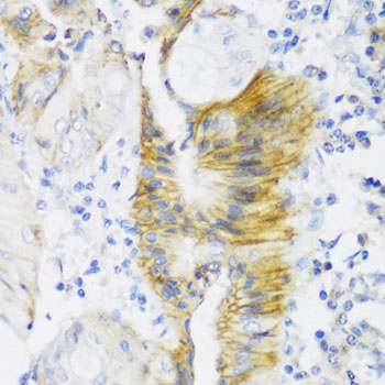 CLDN4 Rabbit Polyclonal Antibody - Image 2