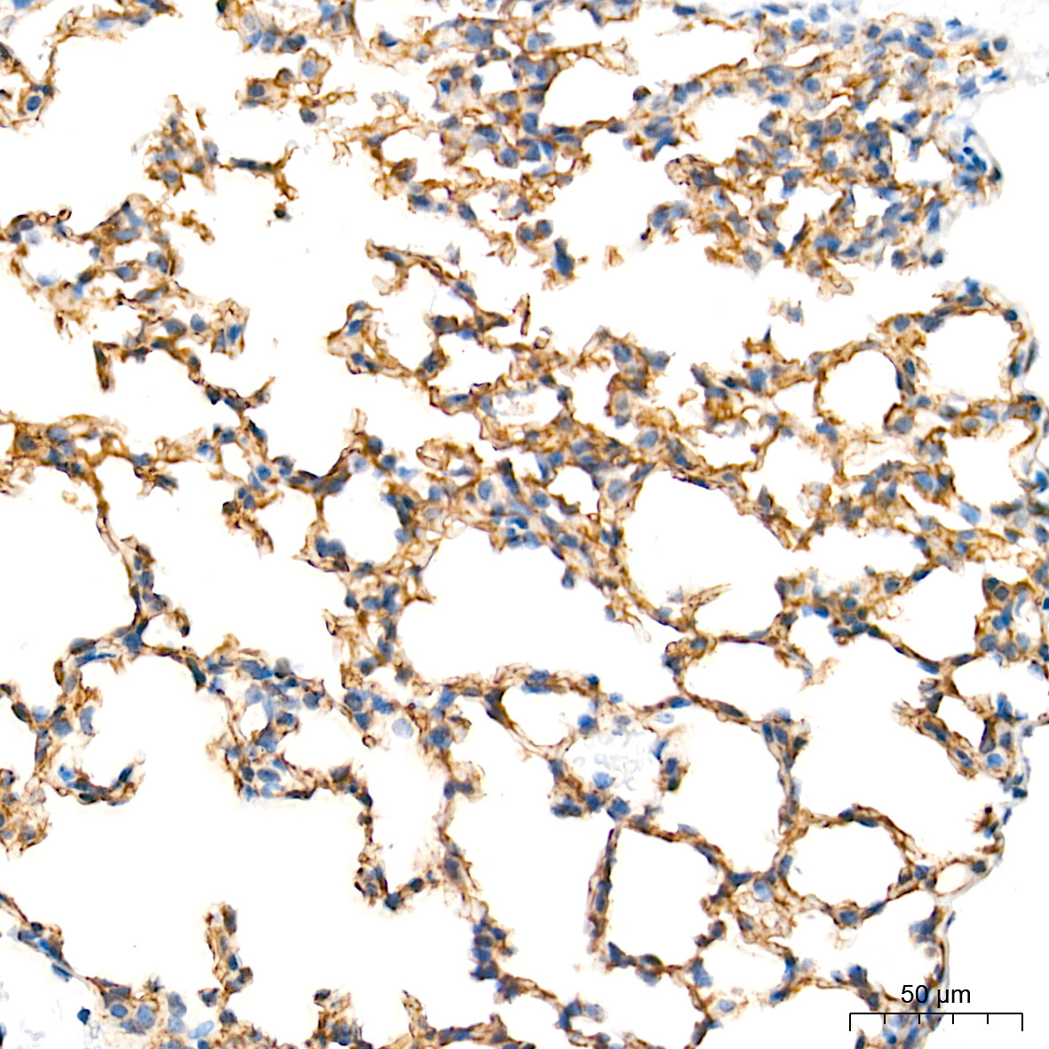 CLDN5 Rabbit Polyclonal Antibody - Image 2