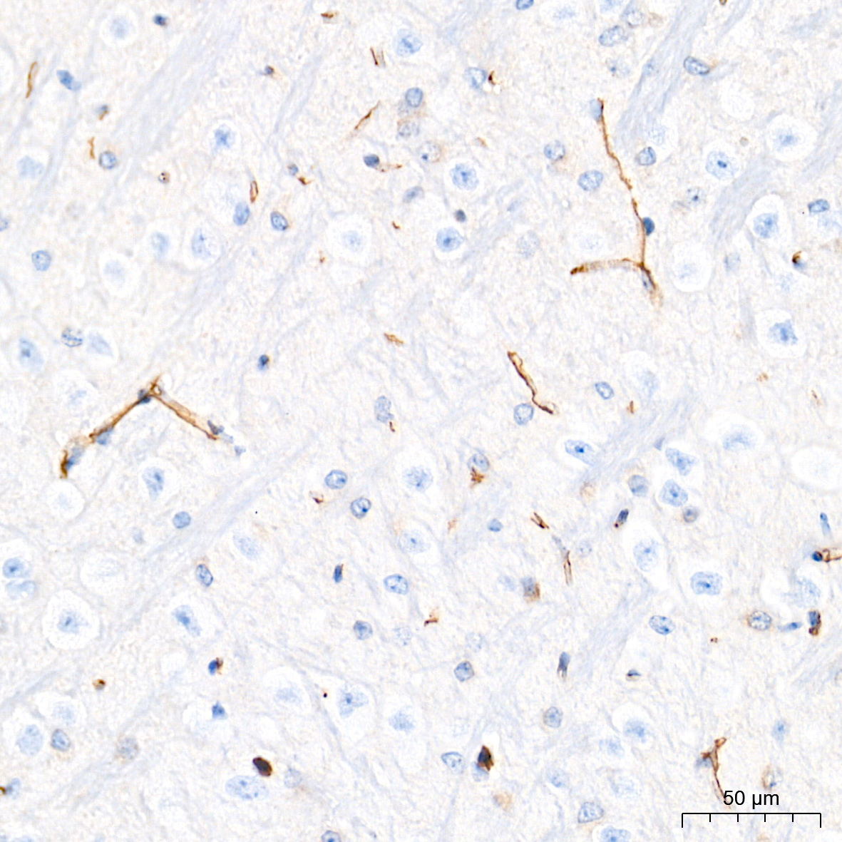 CLDN5 Rabbit Polyclonal Antibody - Image 3