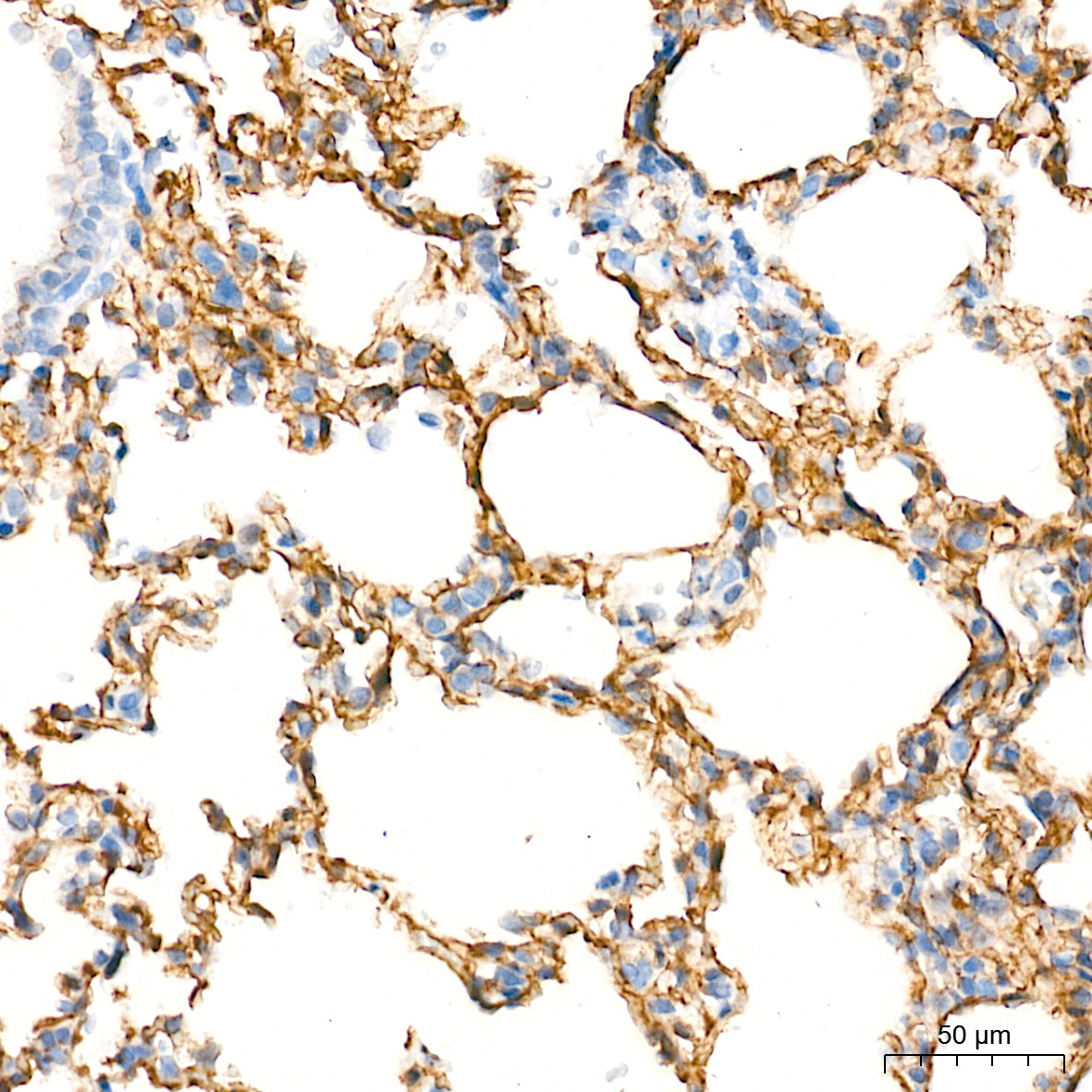CLDN5 Rabbit Polyclonal Antibody - Image 4