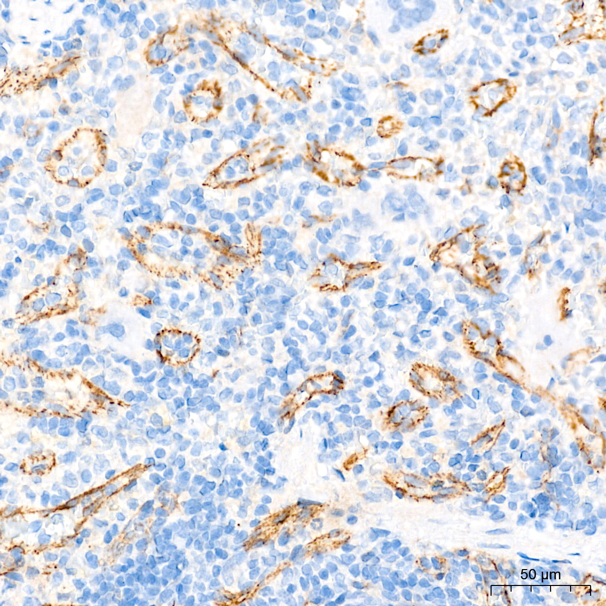 CLDN5 Rabbit Polyclonal Antibody - Image 5