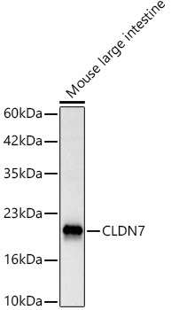 CLDN7 Rabbit Polyclonal Antibody