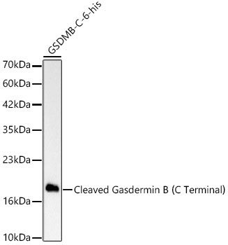 Cleaved Gasdermin B?C Terminal? Rabbit Monoclonal Antibody