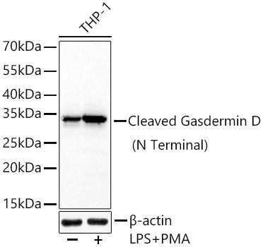 Cleaved Gasdermin D (N Terminal) Rabbit Monoclonal Antibody