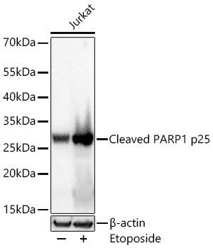 Cleaved PARP1 p25 Rabbit Monoclonal Antibody - Image 2