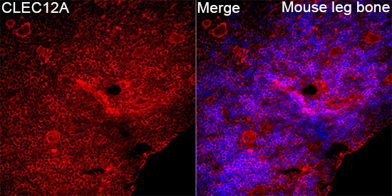 CLEC12A Rabbit Polyclonal Antibody - Image 2