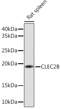 CLEC2B Rabbit Polyclonal Antibody