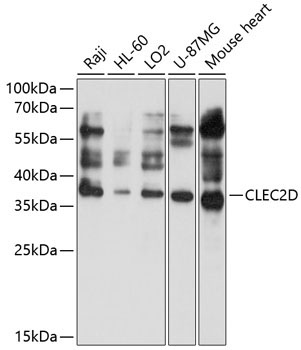 CLEC2D Rabbit Polyclonal Antibody