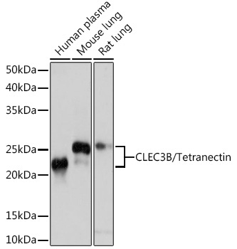 CLEC3B/Tetranectin Rabbit Monoclonal Antibody