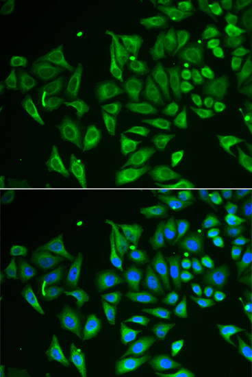 CLEC3B/Tetranectin Rabbit Polyclonal Antibody