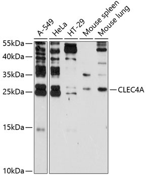 CLEC4A Rabbit Polyclonal Antibody