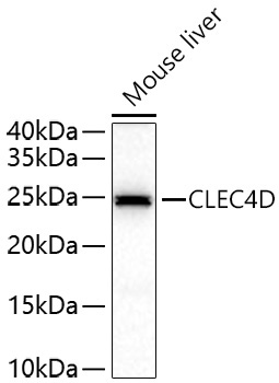 CLEC4D Rabbit Polyclonal Antibody