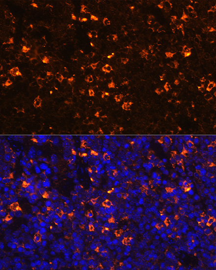 CLEC4D Rabbit Polyclonal Antibody - Image 2