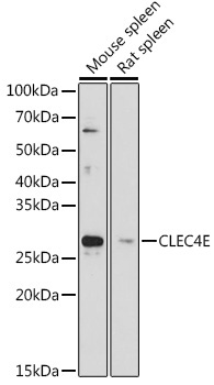 CLEC4E Rabbit Polyclonal Antibody