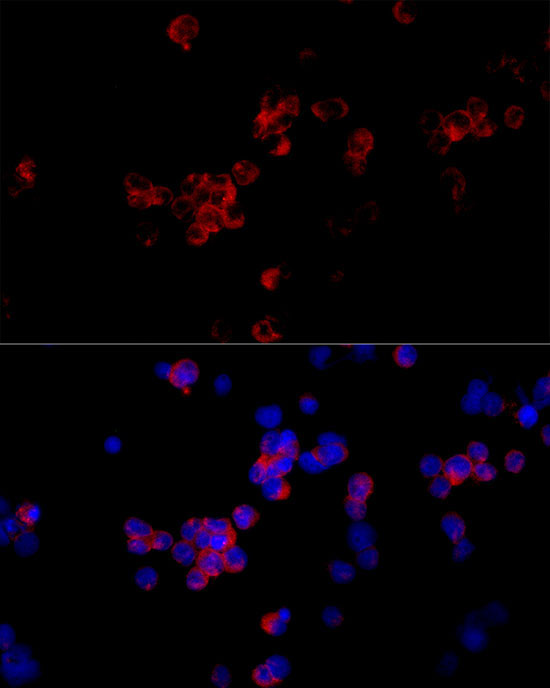 CLEC4M Rabbit Polyclonal Antibody - Image 2