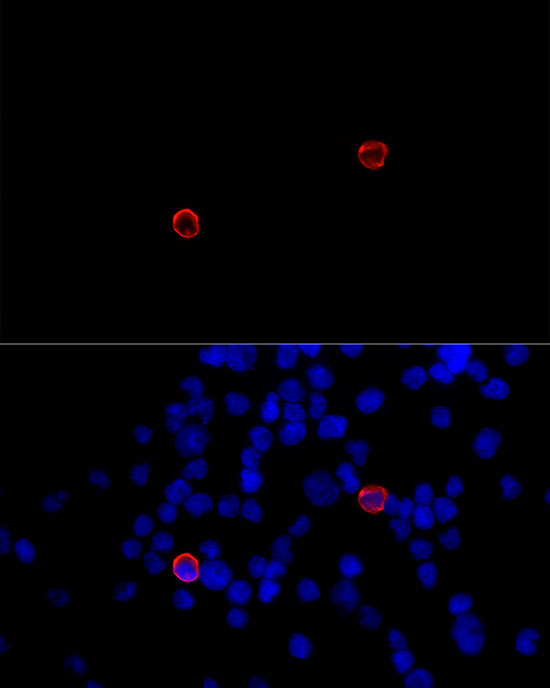 CLEC4M Rabbit Polyclonal Antibody - Image 3