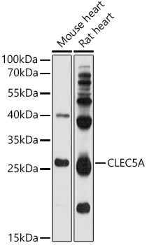CLEC5A Rabbit Polyclonal Antibody