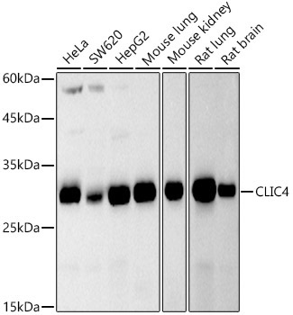 CLIC4 Rabbit Monoclonal Antibody