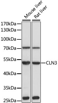 CLN3 Rabbit Polyclonal Antibody
