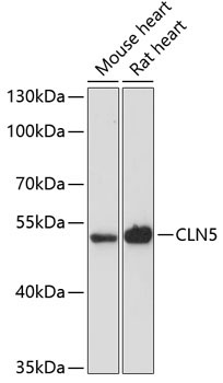 CLN5 Rabbit Polyclonal Antibody