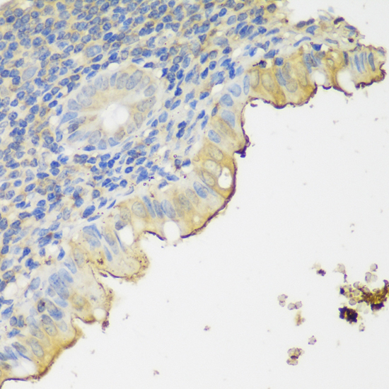 CLN5 Rabbit Polyclonal Antibody - Image 2