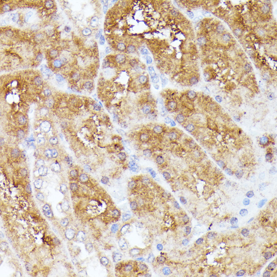 CLNS1A Rabbit Polyclonal Antibody - Image 2