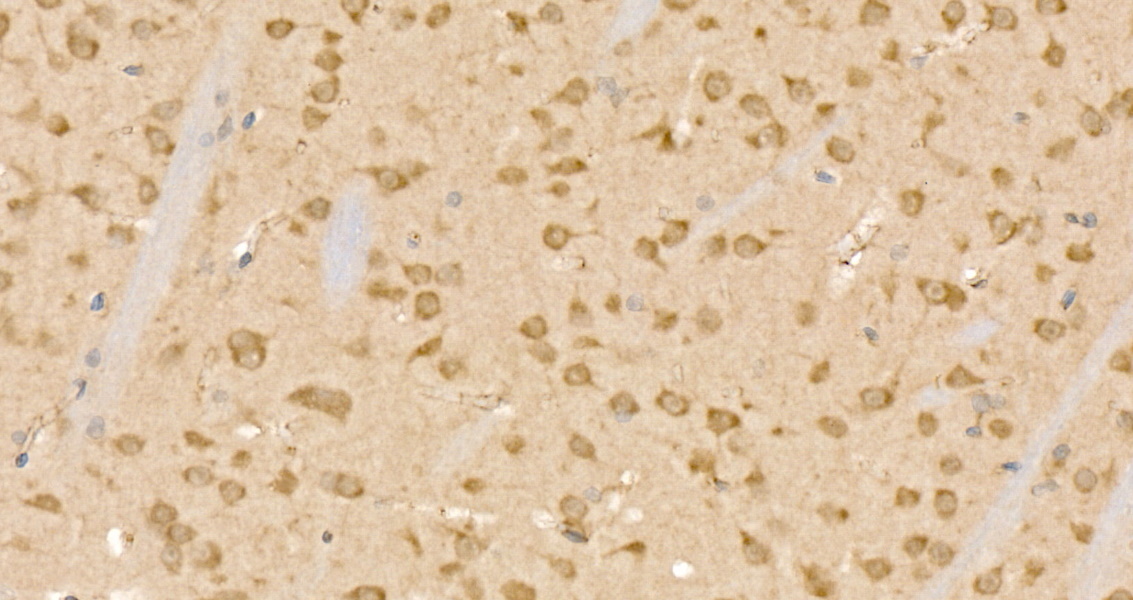 CLPB Rabbit Polyclonal Antibody