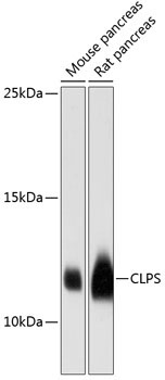 CLPS Rabbit Polyclonal Antibody