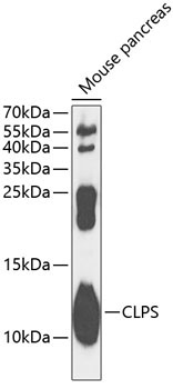CLPS Rabbit Polyclonal Antibody