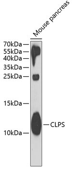 CLPS Rabbit Polyclonal Antibody