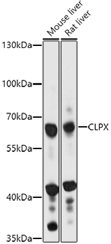CLPX Rabbit Polyclonal Antibody