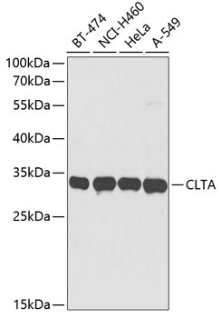 CLTA Rabbit Polyclonal Antibody