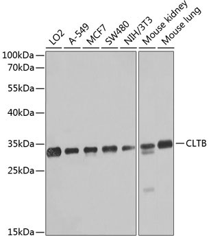 CLTB Rabbit Polyclonal Antibody