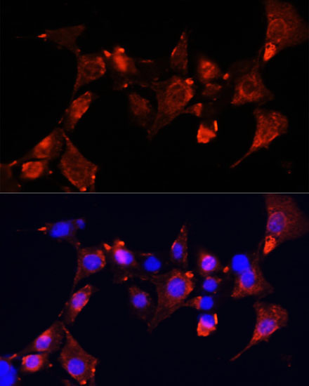 CLUH Rabbit Polyclonal Antibody - Image 2
